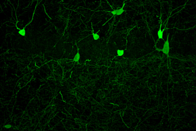 Transplanted inhibitory neurons (green) successfully integrated into the hippocampus of a recipient mouse.