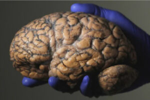 A gloved hand holds a brain.