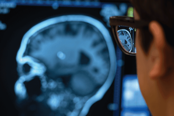 A person with glasses stares at a blurry MRI scan of a brain